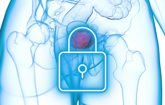 Blasenspeicherstörung
