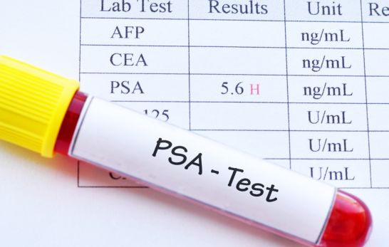 PSA-Test - Prostata-spezifische Antigen-Wert (PSA-Wert)